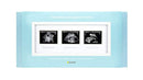 Pearhead Triple Sonogram Pregnancy Keepsake Frame, White