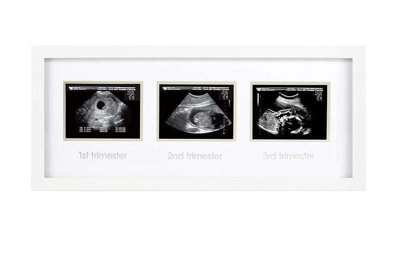 Pearhead Triple Sonogram Pregnancy Keepsake Frame, White